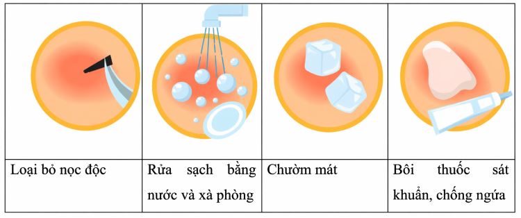 Cách xử lý khi bị côn trùng cắn