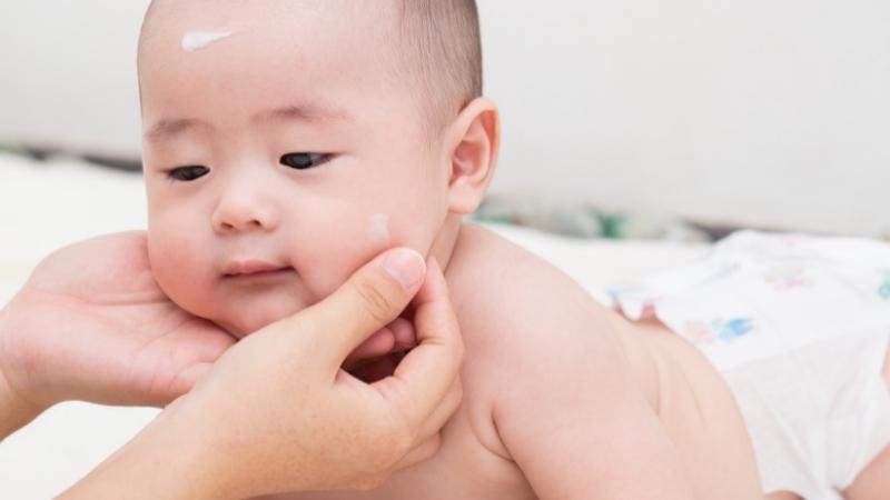 Trẻ bị nổi mẩn đỏ như muỗi đốt